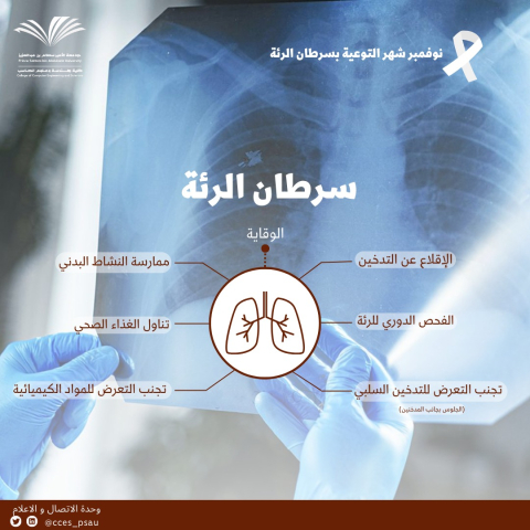 Lung cancer prevention